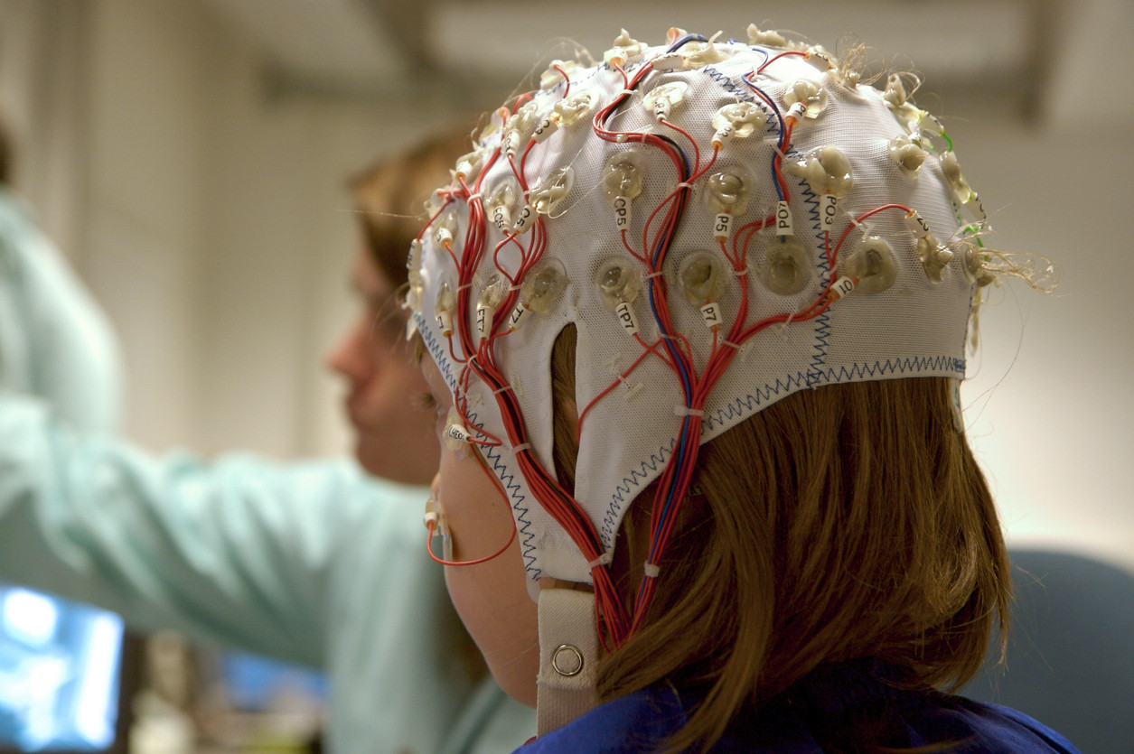 Z historie epilepsie - post cover